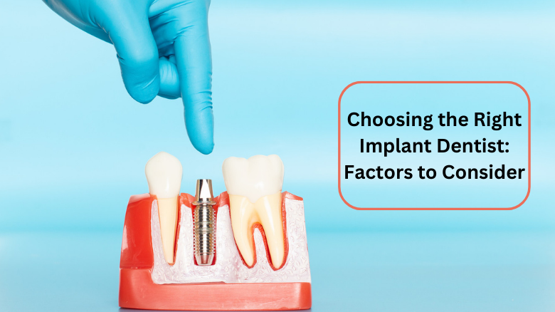 Choosing the Right Implant Dentist_ Factors to Consider