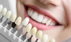 pediatric dentist hyderabad