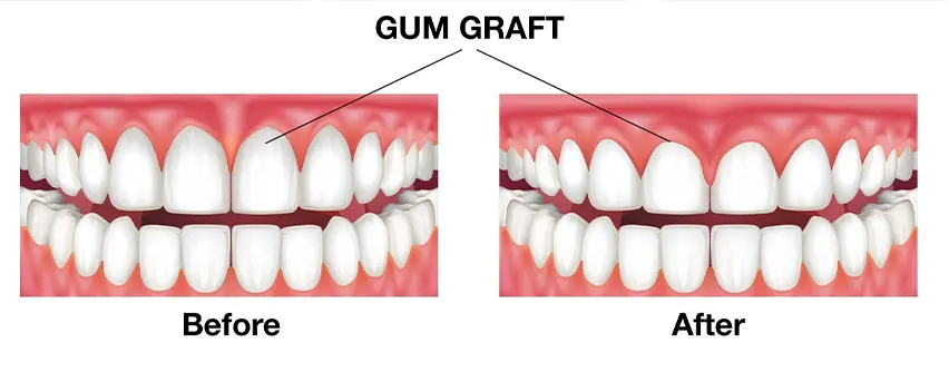 oral surgeon Hyderabad