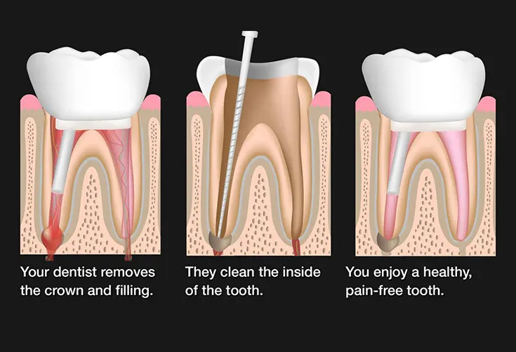 dentist in hyderabad