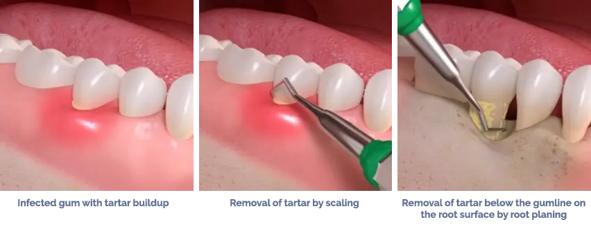 oral surgeon Hyderabad