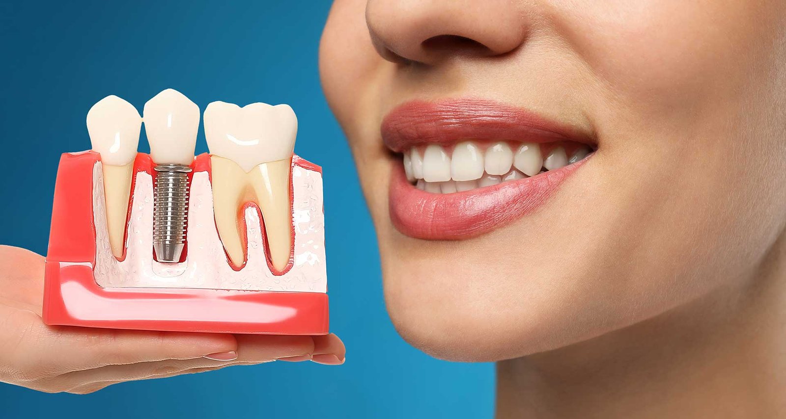 dental implant treatment in hyderabad