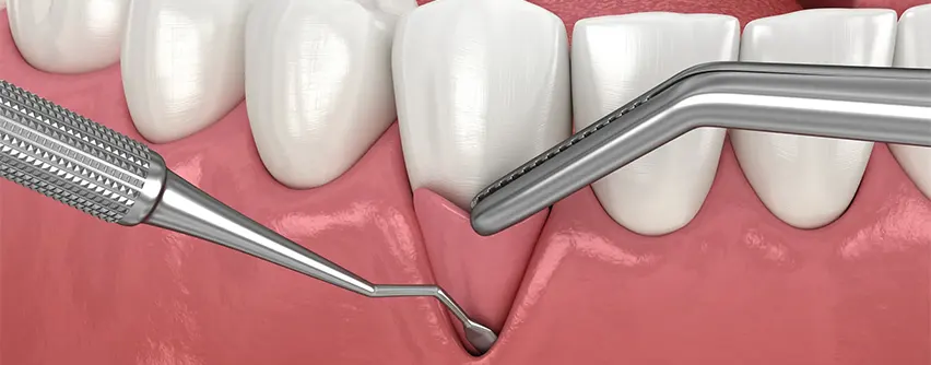dental surgeon in hyderabad